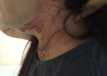 Cozinheira leva facada na cabeça durante assalto em ponto de ônibus na Capital