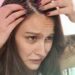 Queda de cabelo é um dos sintomas pós-covid que pacientes têm enfrentado