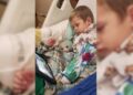 Criança de 3 anos com covid-19 sofre AVC e fica com parte do corpo paralisado