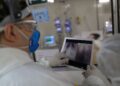 Fiocruz: síndrome respiratória grave tende a aumentar em oito estados