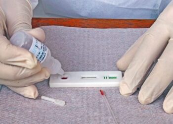 Procon encontra variação de 253,54% em preços de exames da Covid em MS