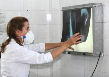Brasil está entre os 20 países com maior concentração de casos de tuberculose
