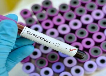 MS tem novo recorde de casos confirmados; foram mais de 3 mil em 24horas