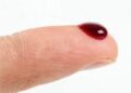 Em plena Pandemia, população deixa de doar sangue e Hemosul tem que fazer campanha