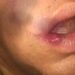 Travesti é agredida ao sair com amigas e registra caso na polícia como homofobia