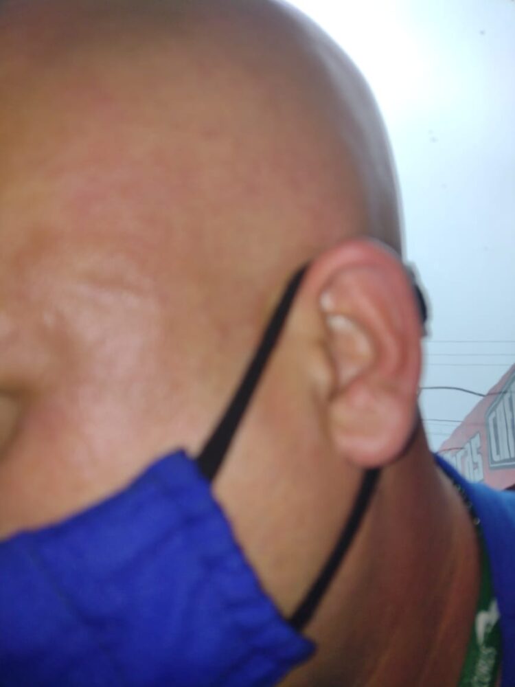 Motorista do transporte público vai à polícia ao ter olho quase perfurado durante agressão