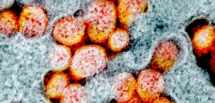 Confirmado primeiro caso de brasileiro infectado com variante da quarta onda vindo da África do Sul