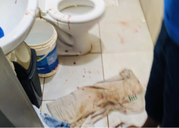 Após briga, irmão quase mata o outro com facadas na cabeça em Dourados