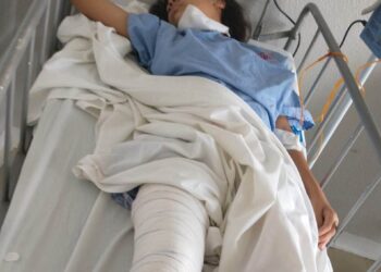 Família pede ajuda para cuidar de menina, após motorista a atropelar e fugir na Capital