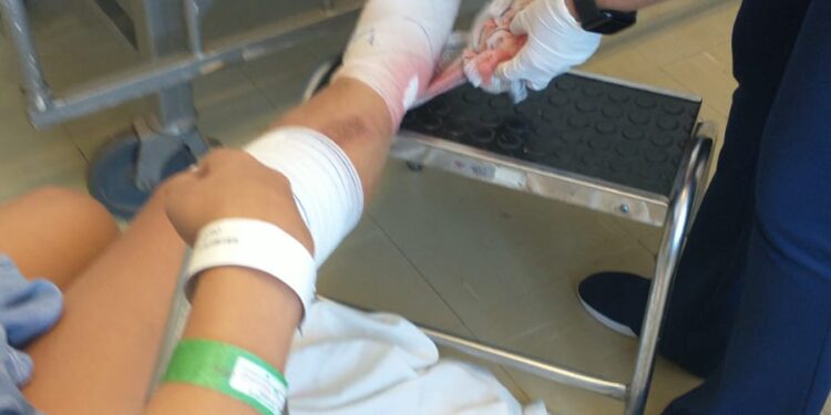 Família pede ajuda para cuidar de menina, após motorista a atropelar e fugir na Capital