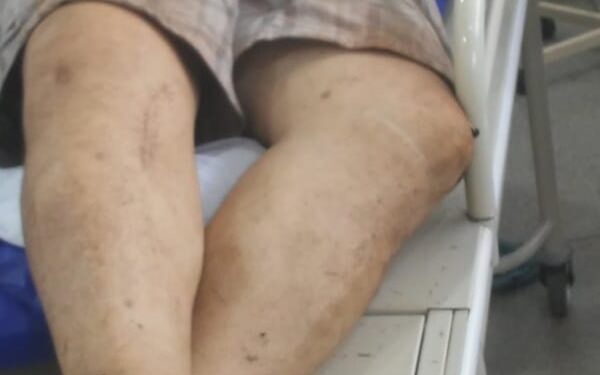 Dupla que manteve motorista de carreta refém de SP à MS é morta pela polícia em confronto