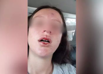 Fábio Trad pede providências ao caso Luana: LGBT agredida pelo vizinho por preconceito