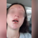 Fábio Trad pede providências ao caso Luana: LGBT agredida pelo vizinho por preconceito