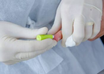 Testagem rápida para Covid e Influenza em trabalho presencial é recomendada pelo Ministério do Trabalho e Previdência