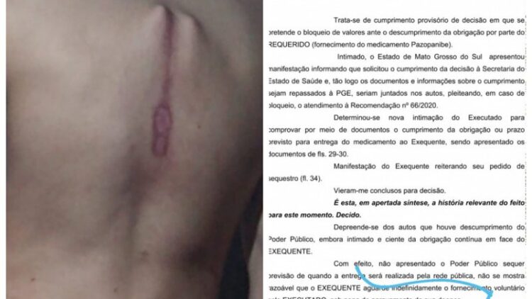 Família tenta desesperada conseguir medicamento de R$ 10 mil para tratar câncer de Arthur