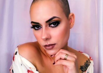 Com cabelo raspado e superando cada dia doença autoimune, Ju Alberton dá um show de beleza na web