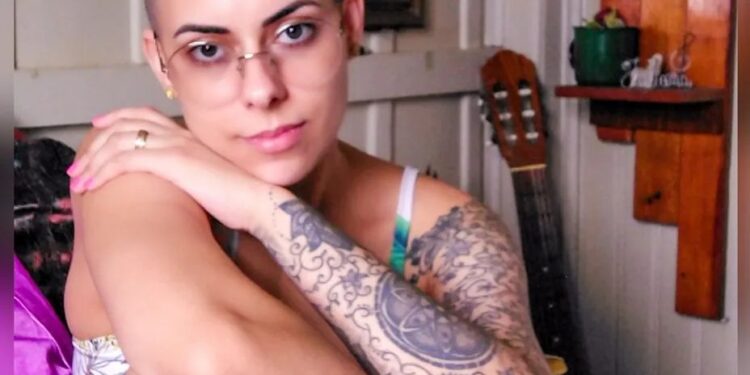 Com cabelo raspado e superando cada dia doença autoimune, Ju Alberton dá um show de beleza na web