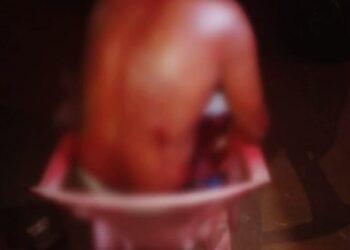 Em briga durante bebedeira, homem é esfaqueado pelas costas por mulher em MS