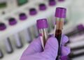 Saúde investiga 7 casos suspeitos de hepatite misteriosa em crianças
