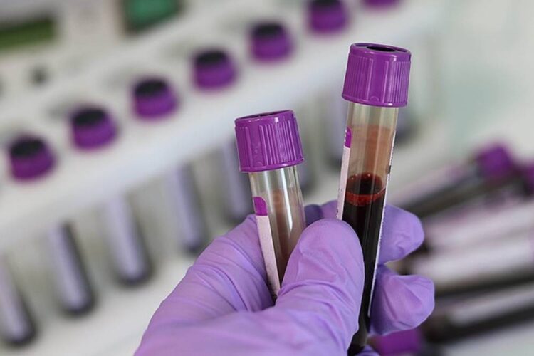 Saúde investiga 7 casos suspeitos de hepatite misteriosa em crianças