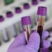 Saúde investiga 7 casos suspeitos de hepatite misteriosa em crianças