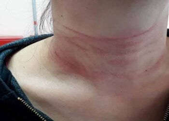 Mesmo com medida protetiva contra filho, idosa quase é morta enforcada por ele em Dourados