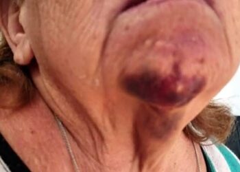 Idosa vai pedir ajuda para mexer em celular e acaba agredida pelo filho e pela nora