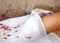 Ex segue mulher até bar e tenta matá-la a golpes de faca dentro do banheiro