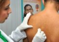 Contactantes de pacientes com Hanseníase passarão por avaliação neste sábado