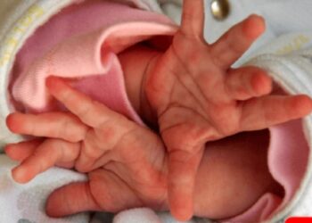 Após bebê não conseguir defecar e chorar muito, mãe descobre estupro do tio de 15 anos