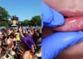 Infectologista faz alerta para doenças mais transmitidas no Carnaval