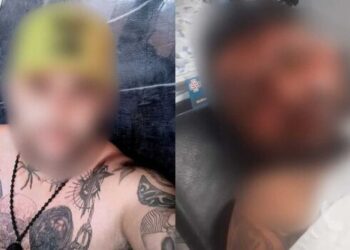 Mulher joga soda cáustica em ex-marido, tatuador em CG, e o deixa cego