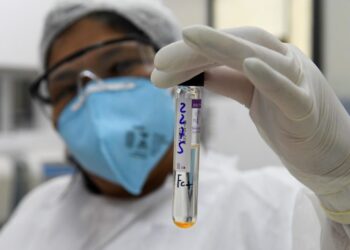 Com prática inovadora, Lacen passará a fazer sequenciamento genômico da turberculose em MS
