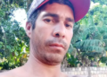 Após ter perna amputada em acidente, motociclista não resiste e morre no hospital