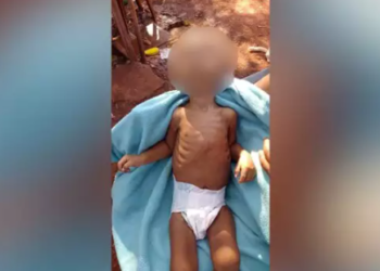 Criança indígena morre de desnutrição e MPF abre procedimento para apurar o caso
