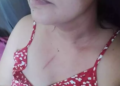 Vereadora no Interior é agredida pelo irmão, que vai preso, e ela desabafa nas redes sociais