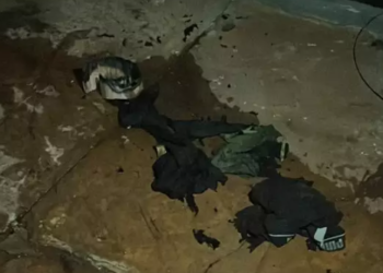 Dois jovens ficam gravemente queimados, após explosão na hora de acender narguilé