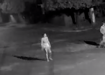 Menino de 4 anos é atacado por Pitbull e tem rosto dilacerado em Ribas