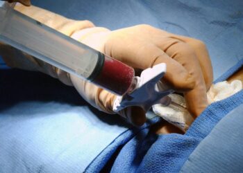 Transplante de Medula óssea: saiba como ser um doador e ajudar a salvar vidas