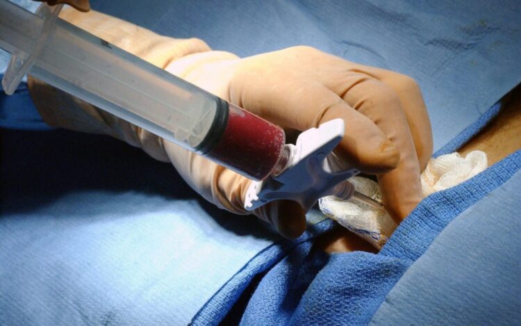 Transplante de Medula óssea: saiba como ser um doador e ajudar a salvar vidas
