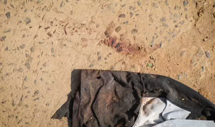Atentados em sequência deixam três rapazes baleados no São Conrado
