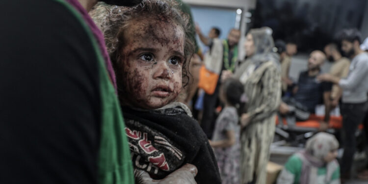 IMAGENS FORTES do horror e brutalidade do ataque a hospital em Gaza