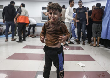 IMAGENS FORTES do horror e brutalidade do ataque a hospital em Gaza