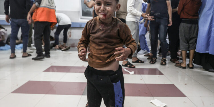 IMAGENS FORTES do horror e brutalidade do ataque a hospital em Gaza