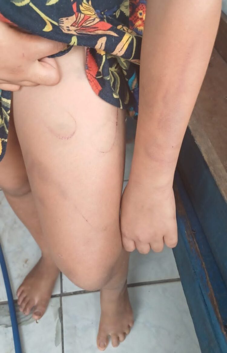 Homem agride enteada autista, ameaça sua convivente e é preso durante ação conjunta de polícias