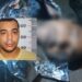 Foragido apontado como ladrão é perseguido por moradores, leva mata-leão e morre