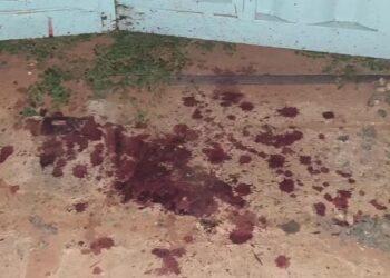 Homem é preso por ferir com garrafa de cerveja e deixar vítima com 18 pontos