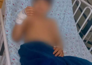 Menino leva tiro na mão enquanto brincava no quintal de casa; polícia procura atiradores