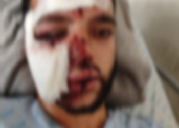 Ciclista está em estado grave na Santa Casa, após ser atropelado por carro, quando voltava do trabalho