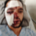 Ciclista está em estado grave na Santa Casa, após ser atropelado por carro, quando voltava do trabalho
